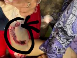 “Miris” Kondisi Almarhumah Kasmawati Sepulang dari RSUD Rantauprapat